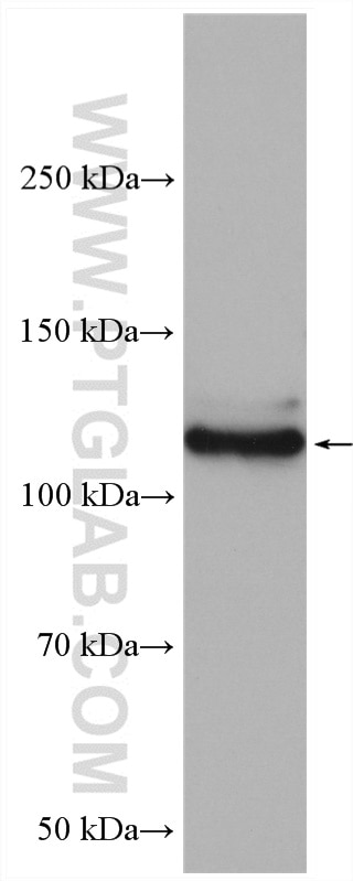 Western Blot (WB) analysis of pig liver tissue using GHR Polyclonal antibody (20713-1-AP)