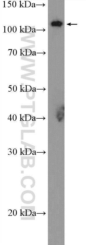 Western Blot (WB) analysis of pig lung tissue using GHR Polyclonal antibody (20713-1-AP)