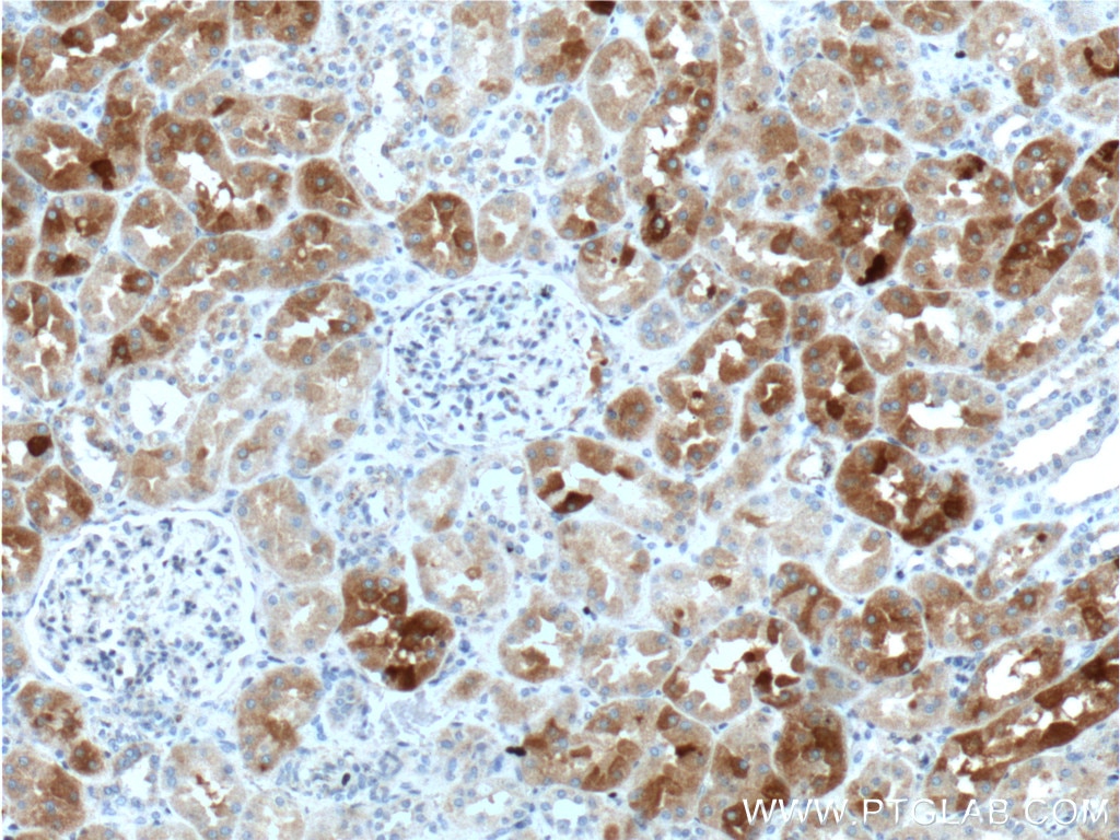 Immunohistochemistry (IHC) staining of human kidney tissue using GHRHR Polyclonal antibody (20715-1-AP)