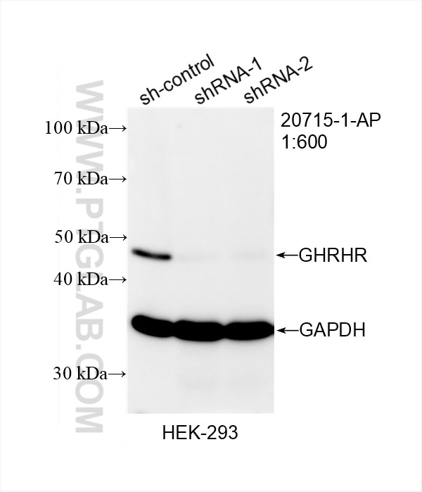 Western Blot (WB) analysis of HEK-293 cells using GHRHR Polyclonal antibody (20715-1-AP)