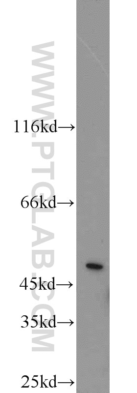 Western Blot (WB) analysis of HEK-293 cells using GHRHR Polyclonal antibody (20715-1-AP)