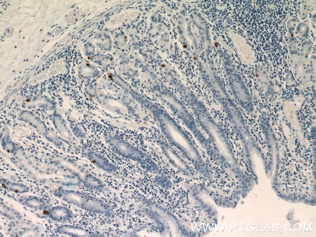 Immunohistochemistry (IHC) staining of human stomach tissue using GHRL Polyclonal antibody (13309-1-AP)