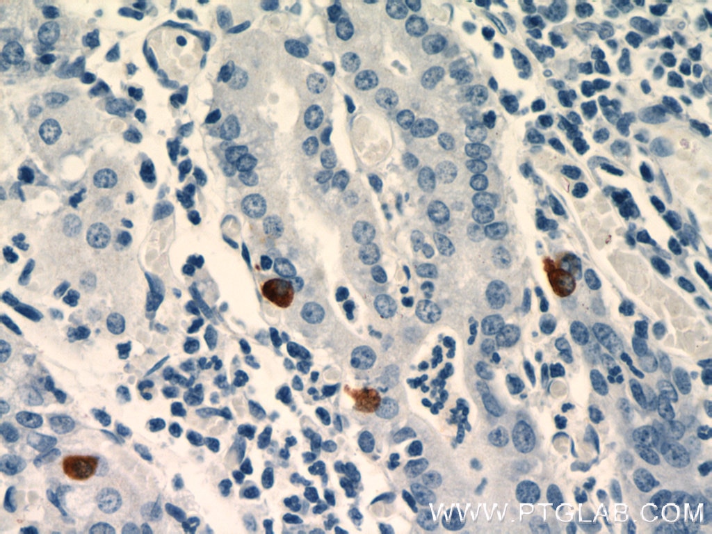 Immunohistochemistry (IHC) staining of human stomach tissue using GHRL Polyclonal antibody (13309-1-AP)