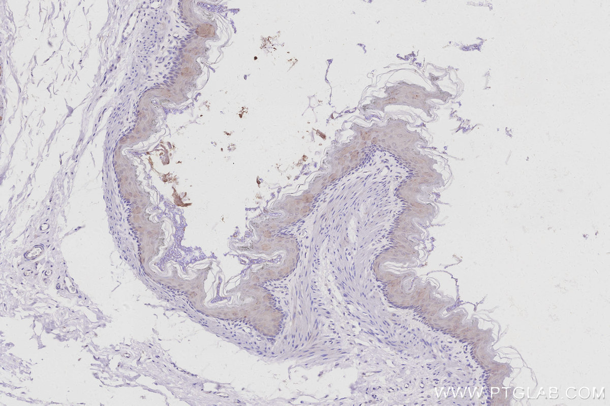 Immunohistochemistry (IHC) staining of rat stomach tissue using GHRL/Ghrelin Polyclonal antibody (13309-1-AP)