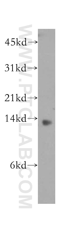 Western Blot (WB) analysis of human stomach tissue using GHRL Polyclonal antibody (13309-1-AP)