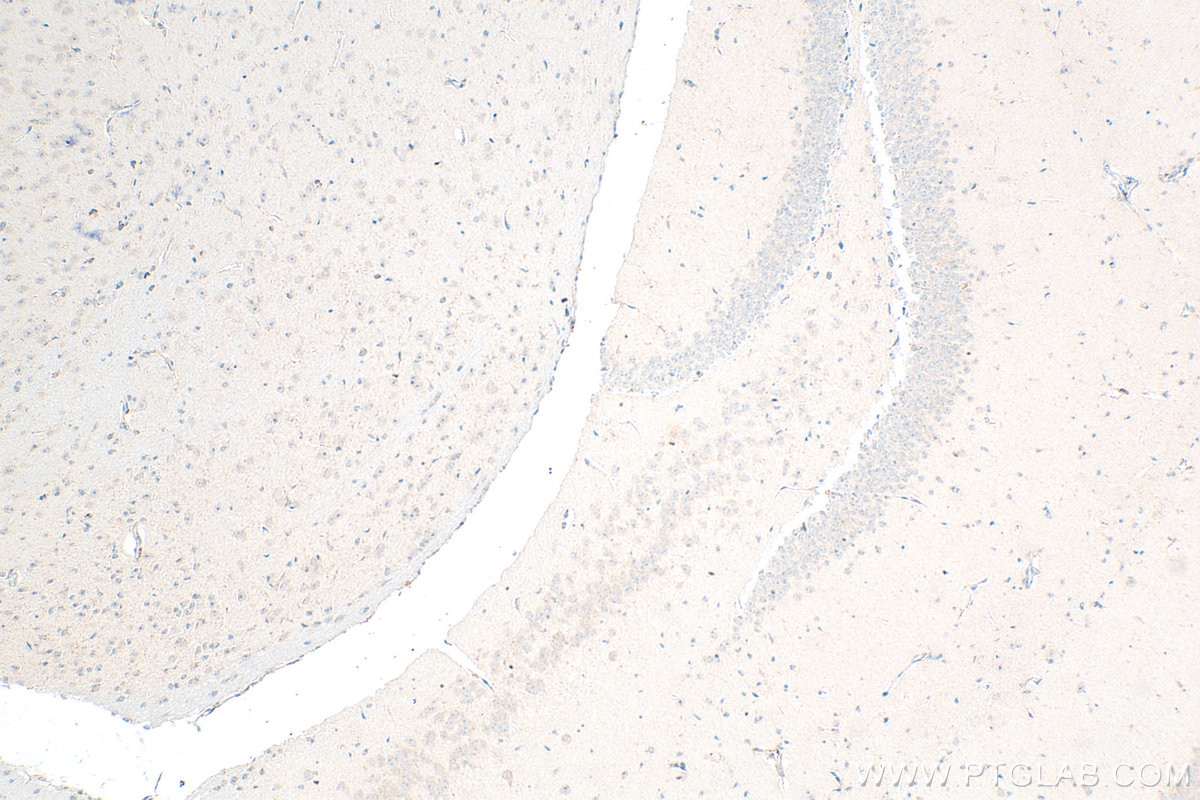 Immunohistochemistry (IHC) staining of mouse brain tissue using GHSR Polyclonal antibody (30602-1-AP)