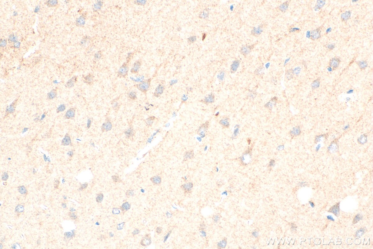 Immunohistochemistry (IHC) staining of rat brain tissue using GHSR Polyclonal antibody (30602-1-AP)