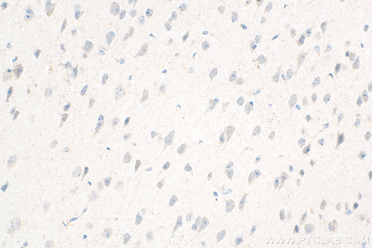 Immunohistochemistry (IHC) staining of mouse brain tissue using GHSR Polyclonal antibody (30602-1-AP)