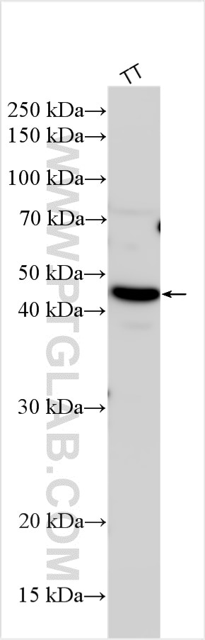Western Blot (WB) analysis of various lysates using GHSR Polyclonal antibody (30602-1-AP)
