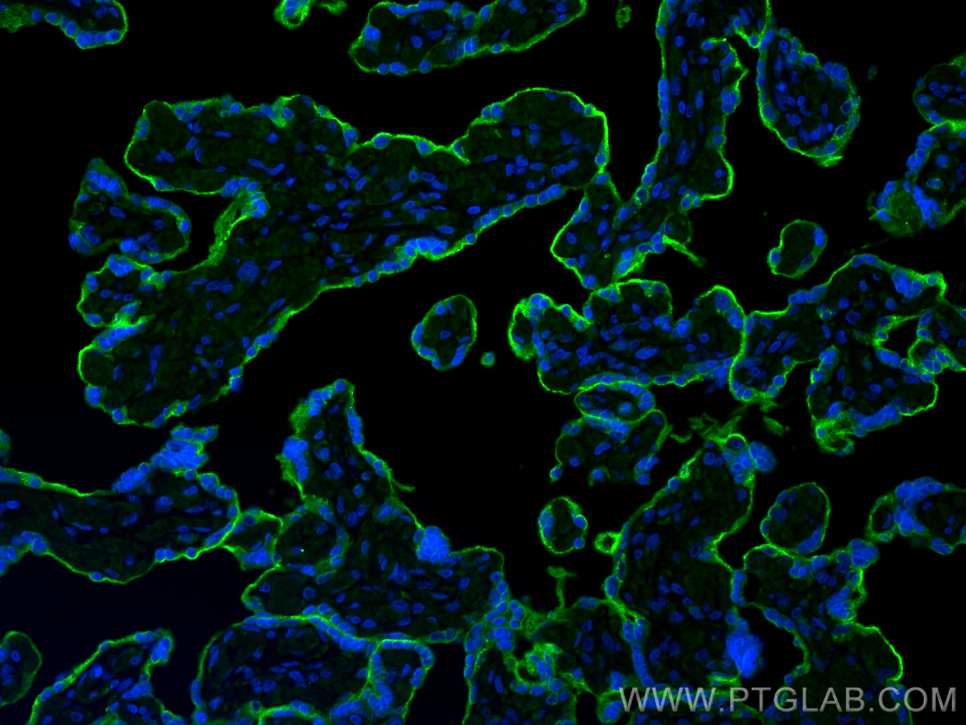 IF Staining of human placenta using 24849-1-AP