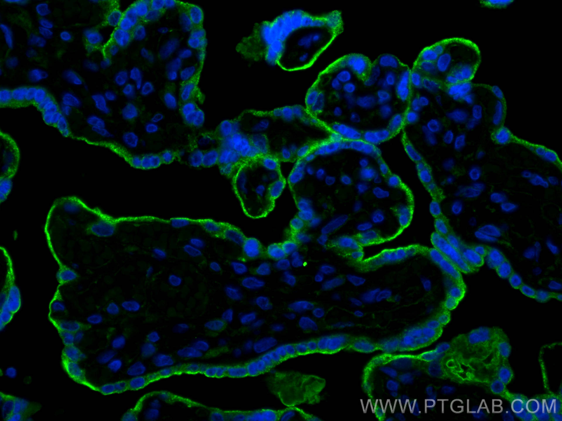 Immunofluorescence (IF) / fluorescent staining of human placenta tissue using VISTA Polyclonal antibody (24849-1-AP)