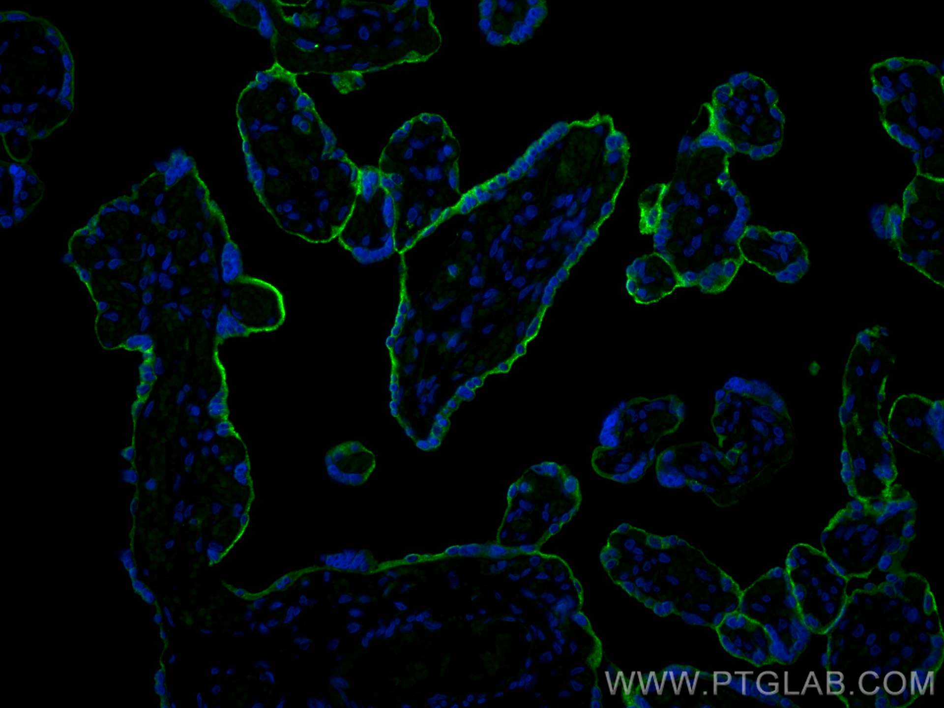 Immunofluorescence (IF) / fluorescent staining of human placenta tissue using VISTA Polyclonal antibody (24849-1-AP)
