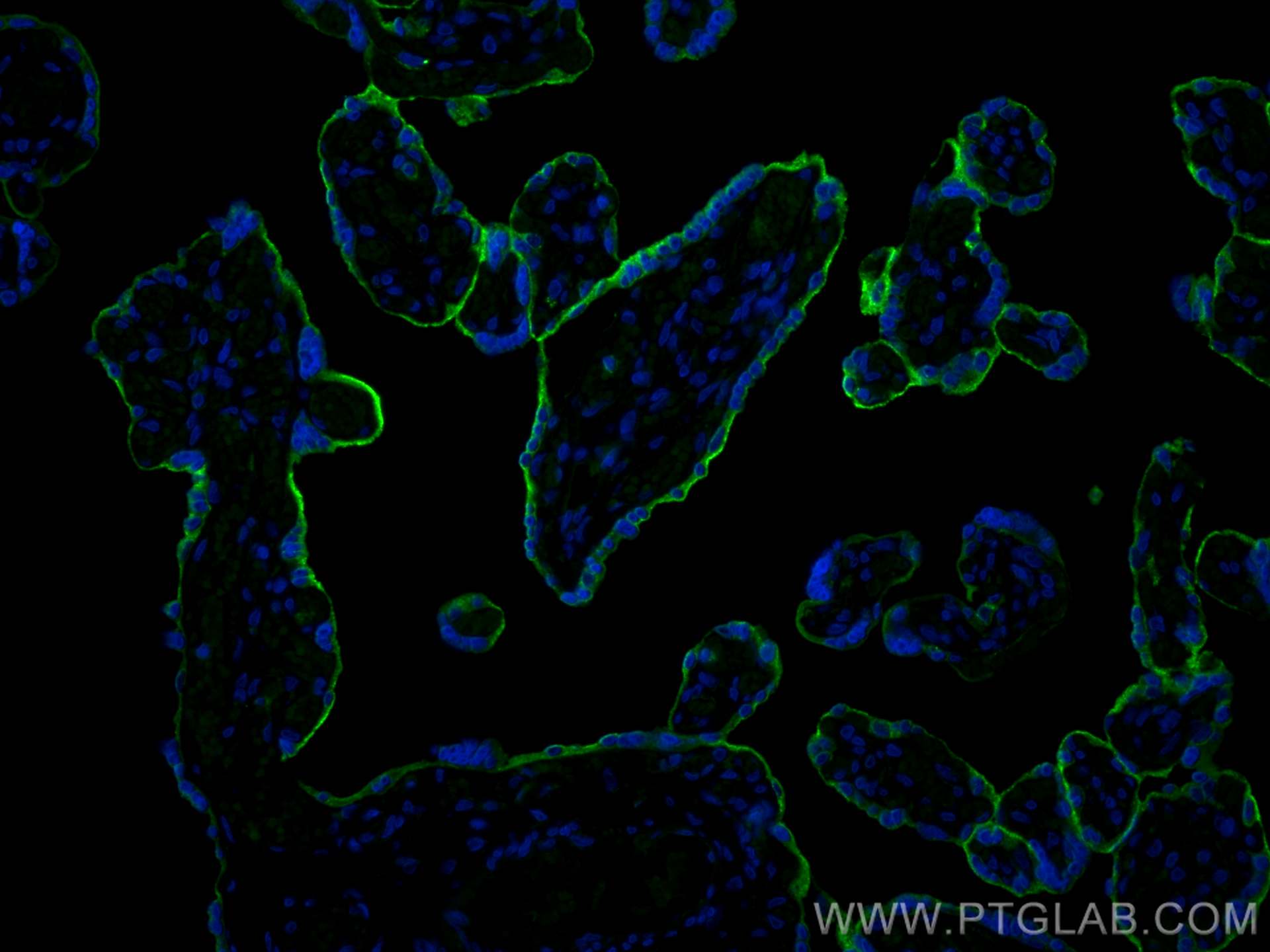 IF Staining of human placenta using 24849-1-AP