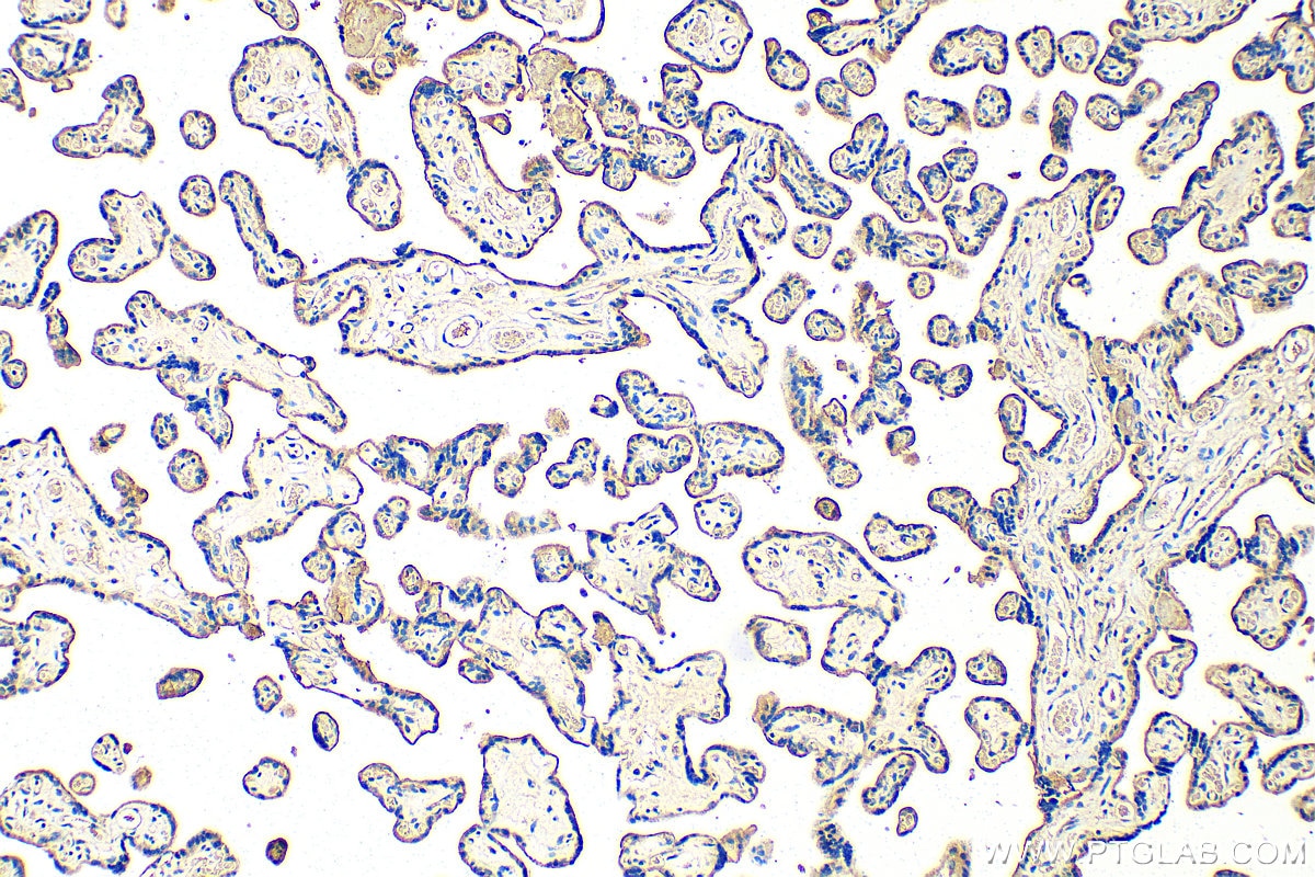 IHC staining of human placenta using 24849-1-AP