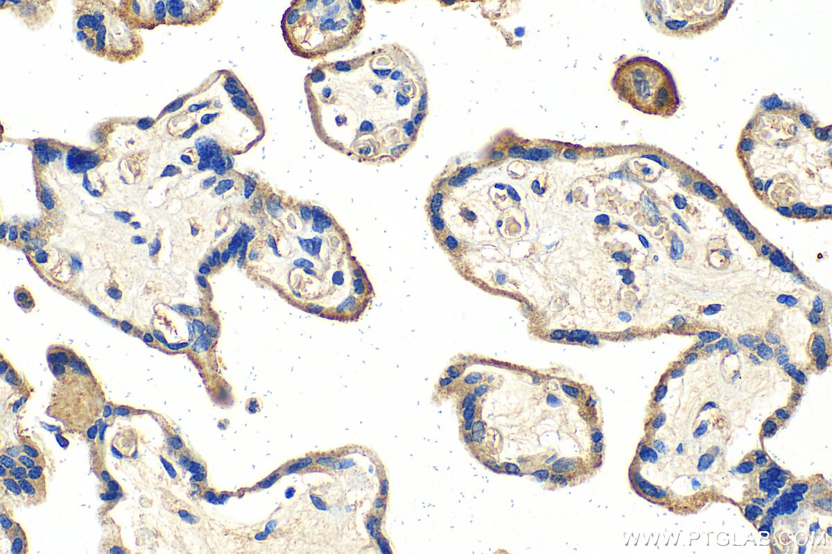 Immunohistochemistry (IHC) staining of human placenta tissue using VISTA Polyclonal antibody (24849-1-AP)