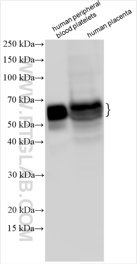 Western Blot (WB) analysis of various lysates using VISTA Polyclonal antibody (24849-1-AP)