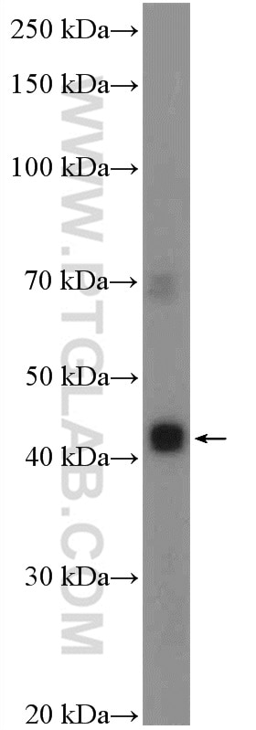 Western Blot (WB) analysis of SH-SY5Y cells using VISTA Polyclonal antibody (24849-1-AP)