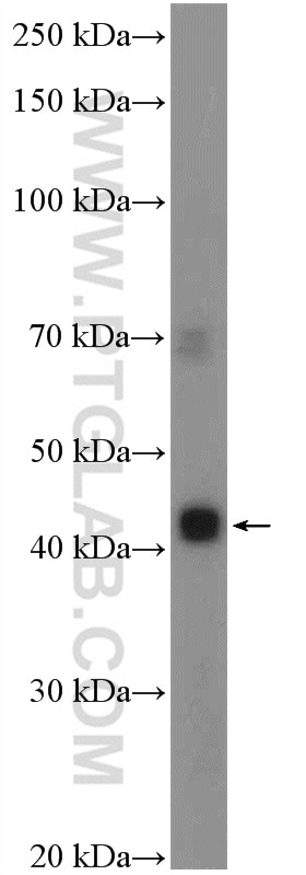 WB analysis of SH-SY5Y using 24849-1-AP