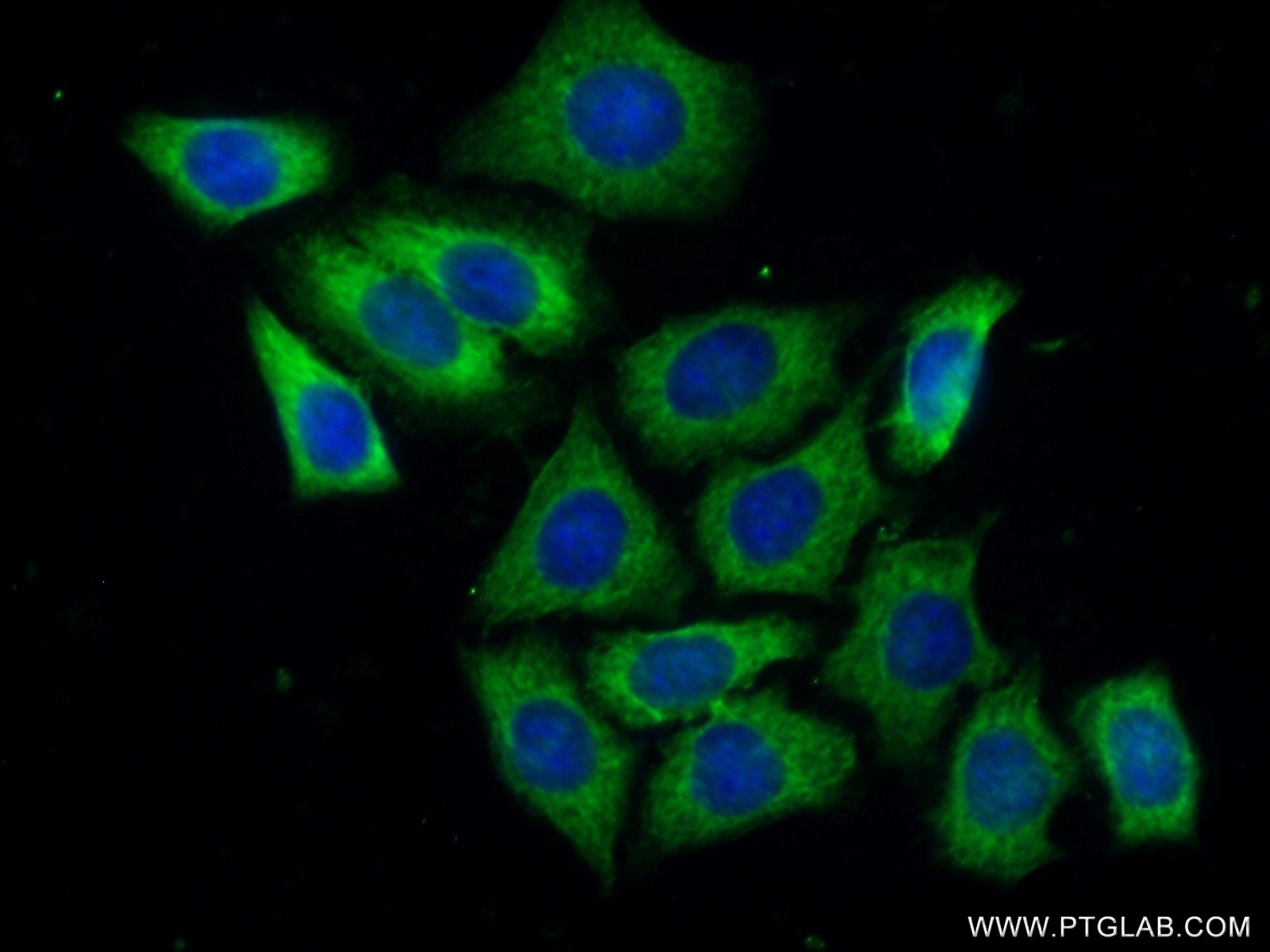 Immunofluorescence (IF) / fluorescent staining of HeLa cells using GIGYF2 Polyclonal antibody (24790-1-AP)