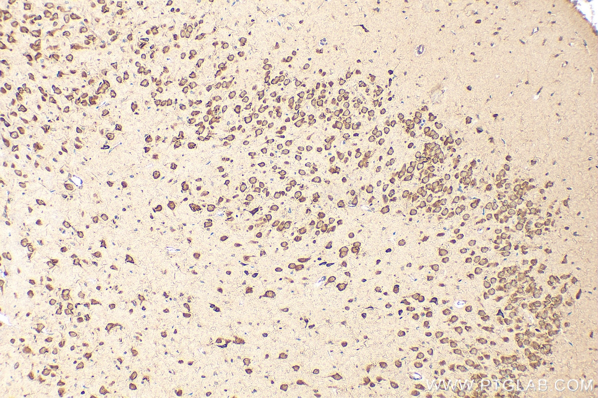 Immunohistochemistry (IHC) staining of rat brain tissue using GIGYF2 Polyclonal antibody (24790-1-AP)