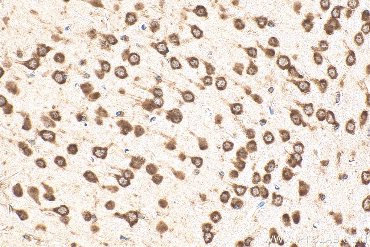 Immunohistochemistry (IHC) staining of mouse brain tissue using GIGYF2 Polyclonal antibody (24790-1-AP)