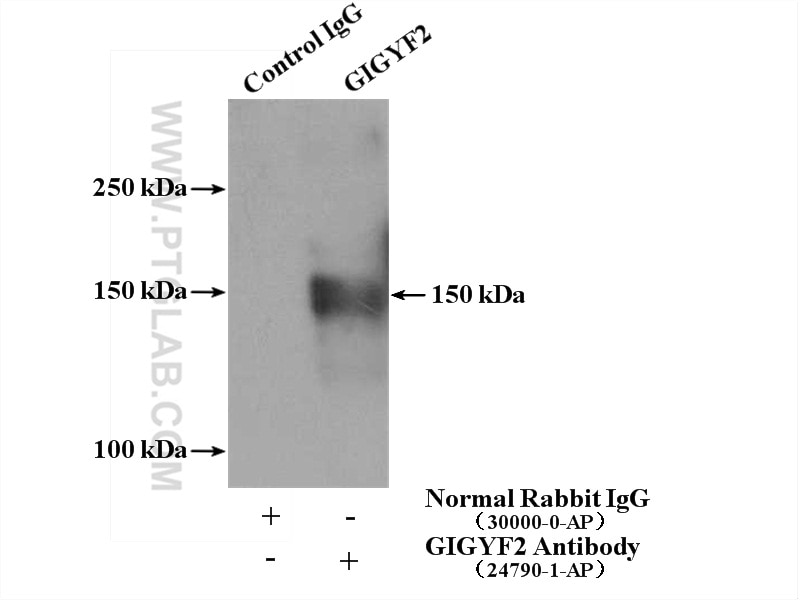 Immunoprecipitation (IP) experiment of Jurkat cells using GIGYF2 Polyclonal antibody (24790-1-AP)