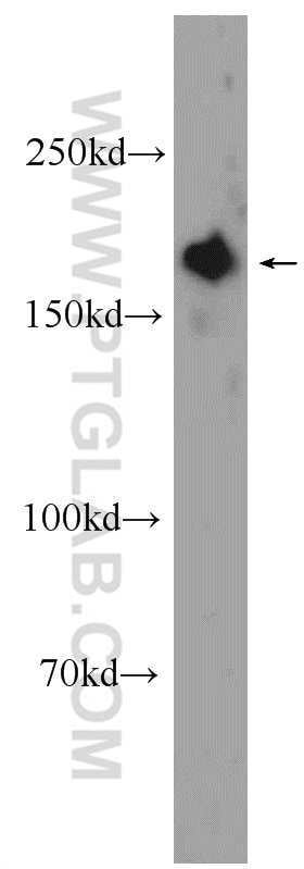 Western Blot (WB) analysis of HeLa cells using GIGYF2 Polyclonal antibody (24790-1-AP)