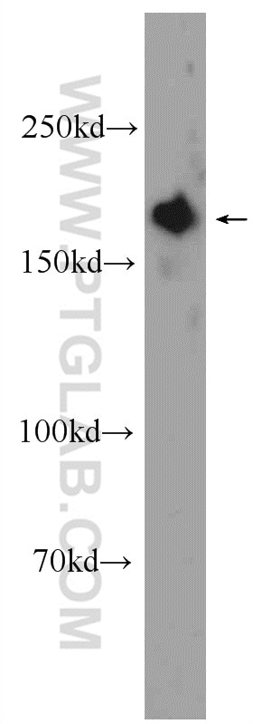 WB analysis of HeLa using 24790-1-AP