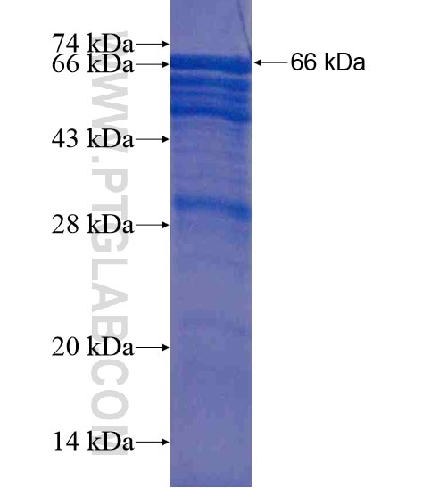 GIGYF2 fusion protein Ag20329 SDS-PAGE