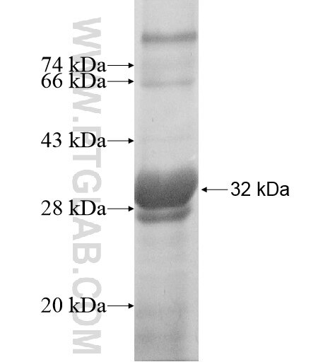 GIMAP1 fusion protein Ag11622 SDS-PAGE