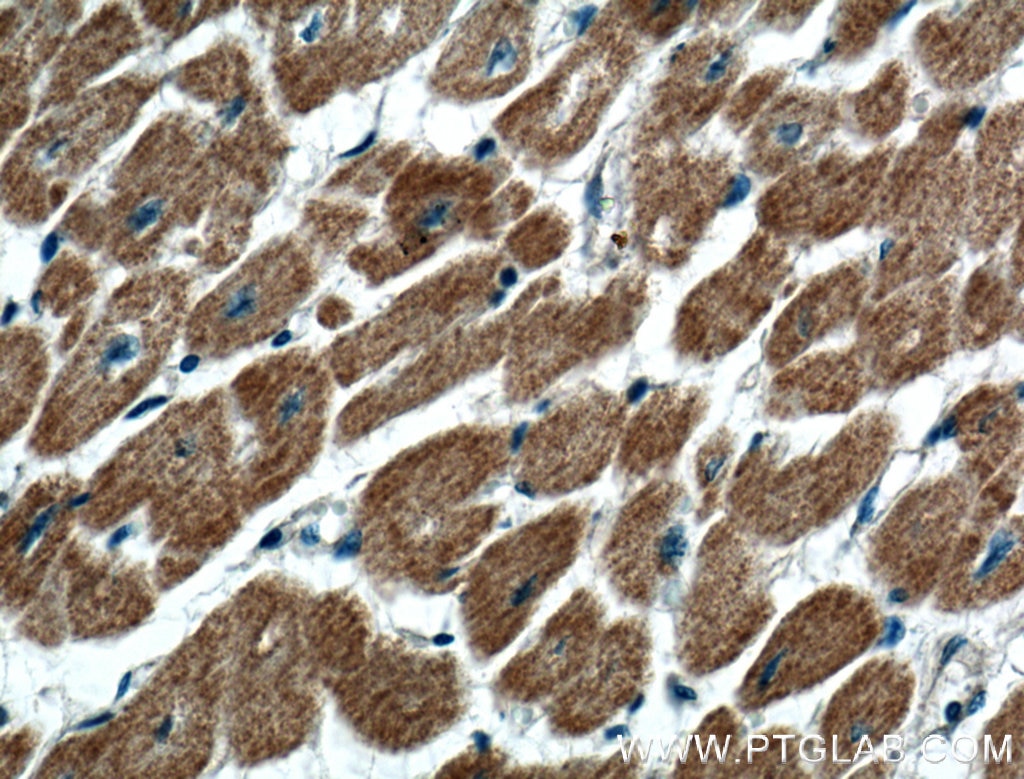 IHC staining of human heart using 13445-1-AP