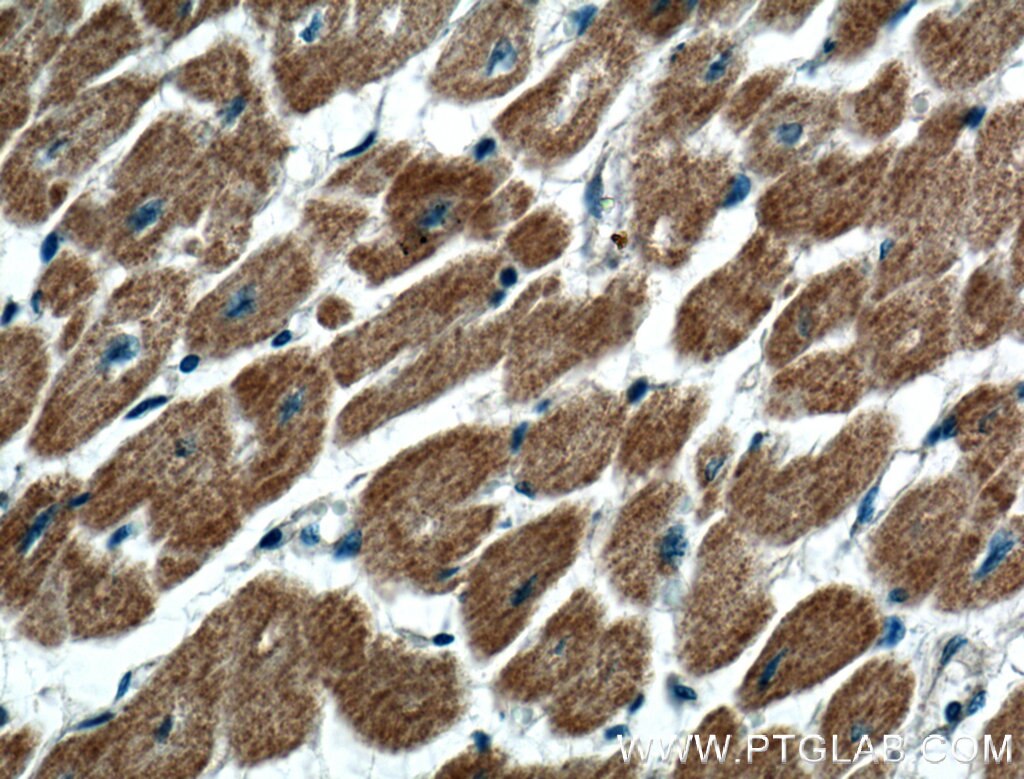 Immunohistochemistry (IHC) staining of human heart tissue using GIMAP2 Polyclonal antibody (13445-1-AP)