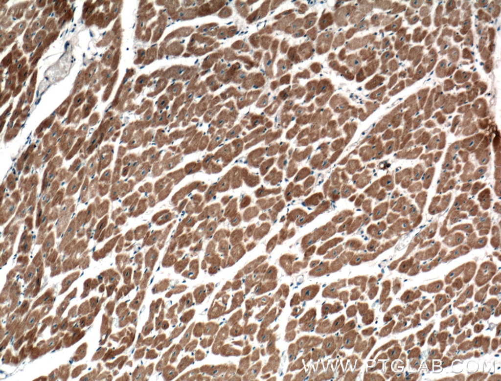 Immunohistochemistry (IHC) staining of human heart tissue using GIMAP2 Polyclonal antibody (13445-1-AP)