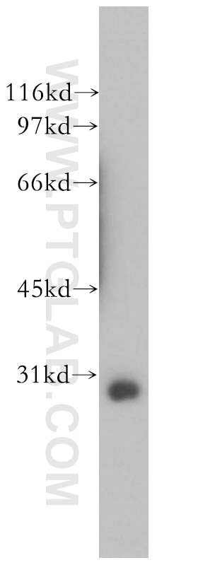 Western Blot (WB) analysis of human kidney tissue using GIMAP2 Polyclonal antibody (13445-1-AP)