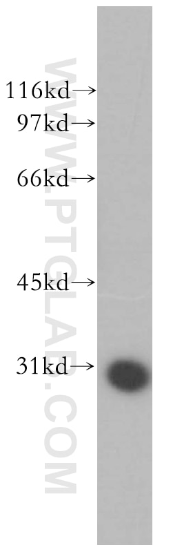 Western Blot (WB) analysis of human heart tissue using GIMAP2 Polyclonal antibody (13445-1-AP)