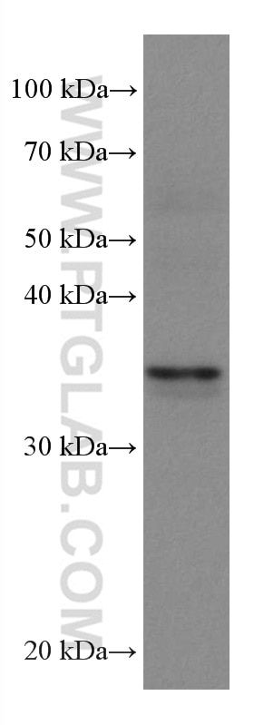 Western Blot (WB) analysis of Jurkat cells using GIMAP2 Monoclonal antibody (67720-1-Ig)