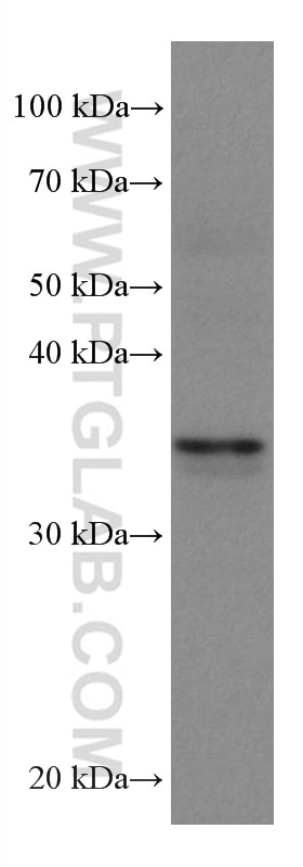 WB analysis of Jurkat using 67720-1-Ig