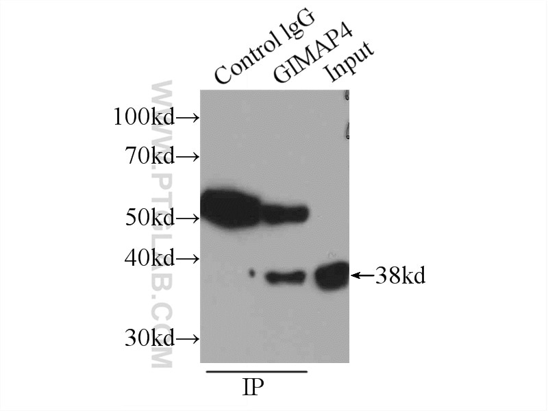 Immunoprecipitation (IP) experiment of Jurkat cells using GIMAP4 Polyclonal antibody (11852-1-AP)