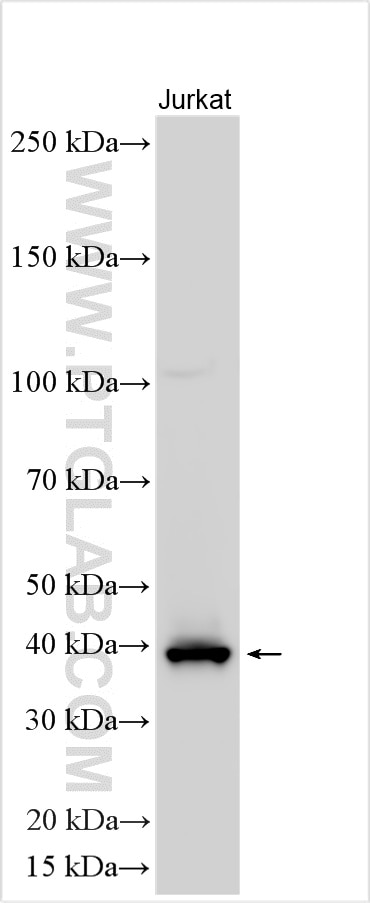 Western Blot (WB) analysis of various lysates using GIMAP4 Polyclonal antibody (11852-1-AP)