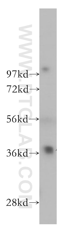 Western Blot (WB) analysis of Jurkat cells using GIMAP4 Polyclonal antibody (11852-1-AP)