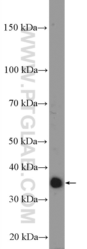 Western Blot (WB) analysis of Jurkat cells using GIMAP5 Polyclonal antibody (11068-1-AP)