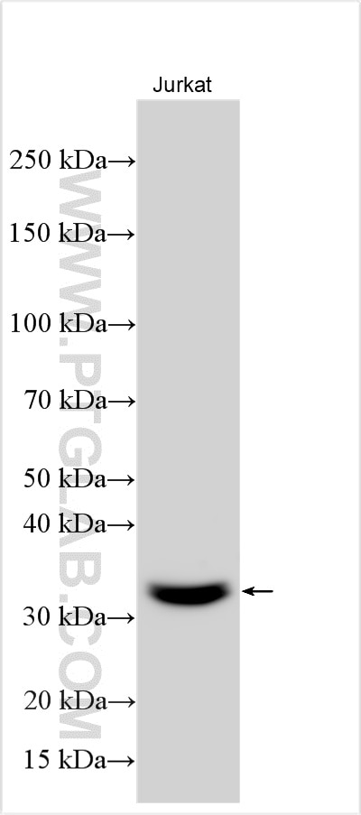 Western Blot (WB) analysis of various lysates using GIMAP5 Polyclonal antibody (11068-1-AP)