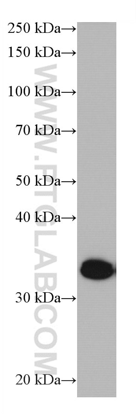 Western Blot (WB) analysis of Jurkat cells using GIMAP5 Monoclonal antibody (66943-1-Ig)