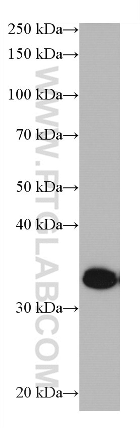 WB analysis of Jurkat using 66943-1-Ig