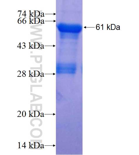 GIMAP5 fusion protein Ag1509 SDS-PAGE