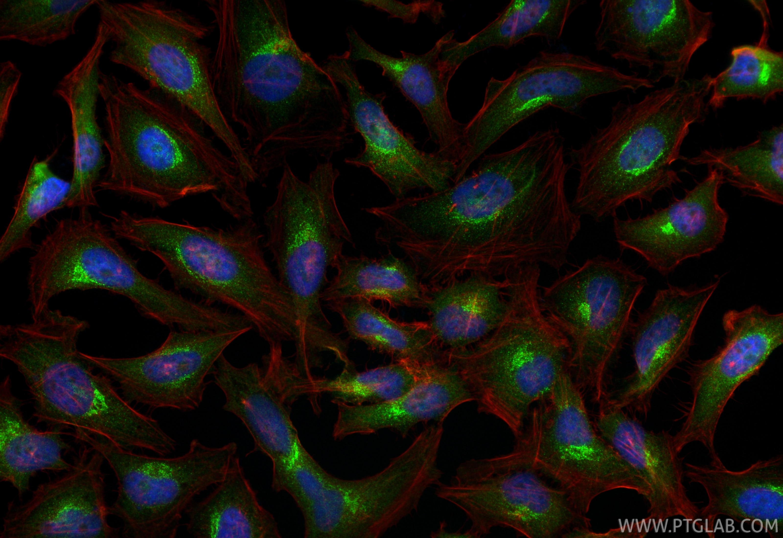 Immunofluorescence (IF) / fluorescent staining of HeLa cells using GIMAP7 Polyclonal antibody (17293-1-AP)