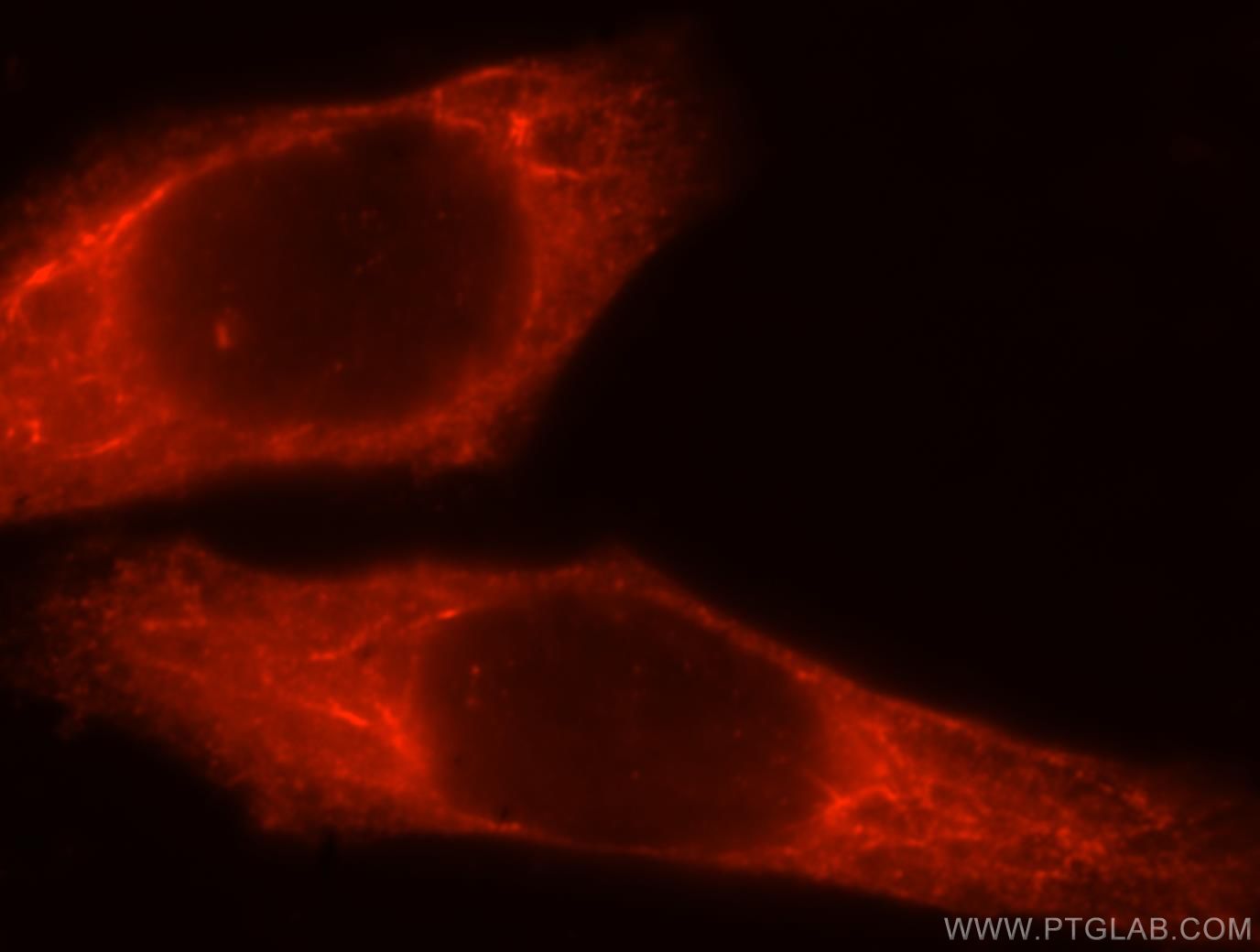 Immunofluorescence (IF) / fluorescent staining of HepG2 cells using GIMAP7 Polyclonal antibody (17293-1-AP)