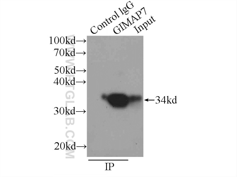 Immunoprecipitation (IP) experiment of Jurkat cells using GIMAP7 Polyclonal antibody (17293-1-AP)