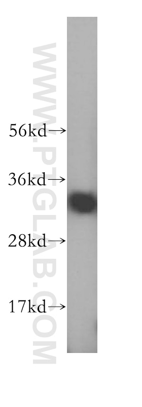 Western Blot (WB) analysis of Jurkat cells using GIMAP7 Polyclonal antibody (17293-1-AP)