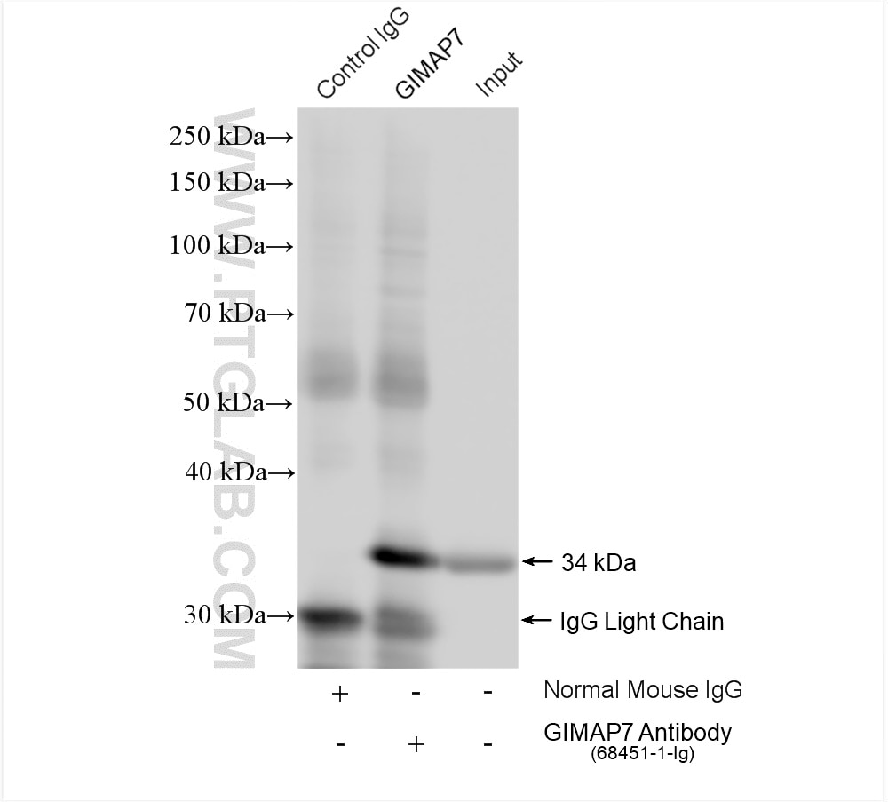 GIMAP7